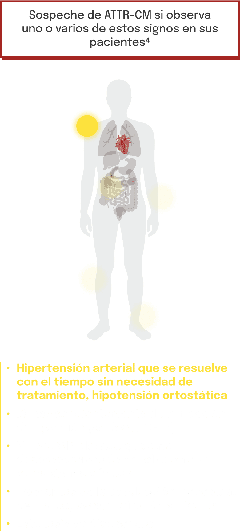 Principales señales de alerta de la ATTR‑CM
