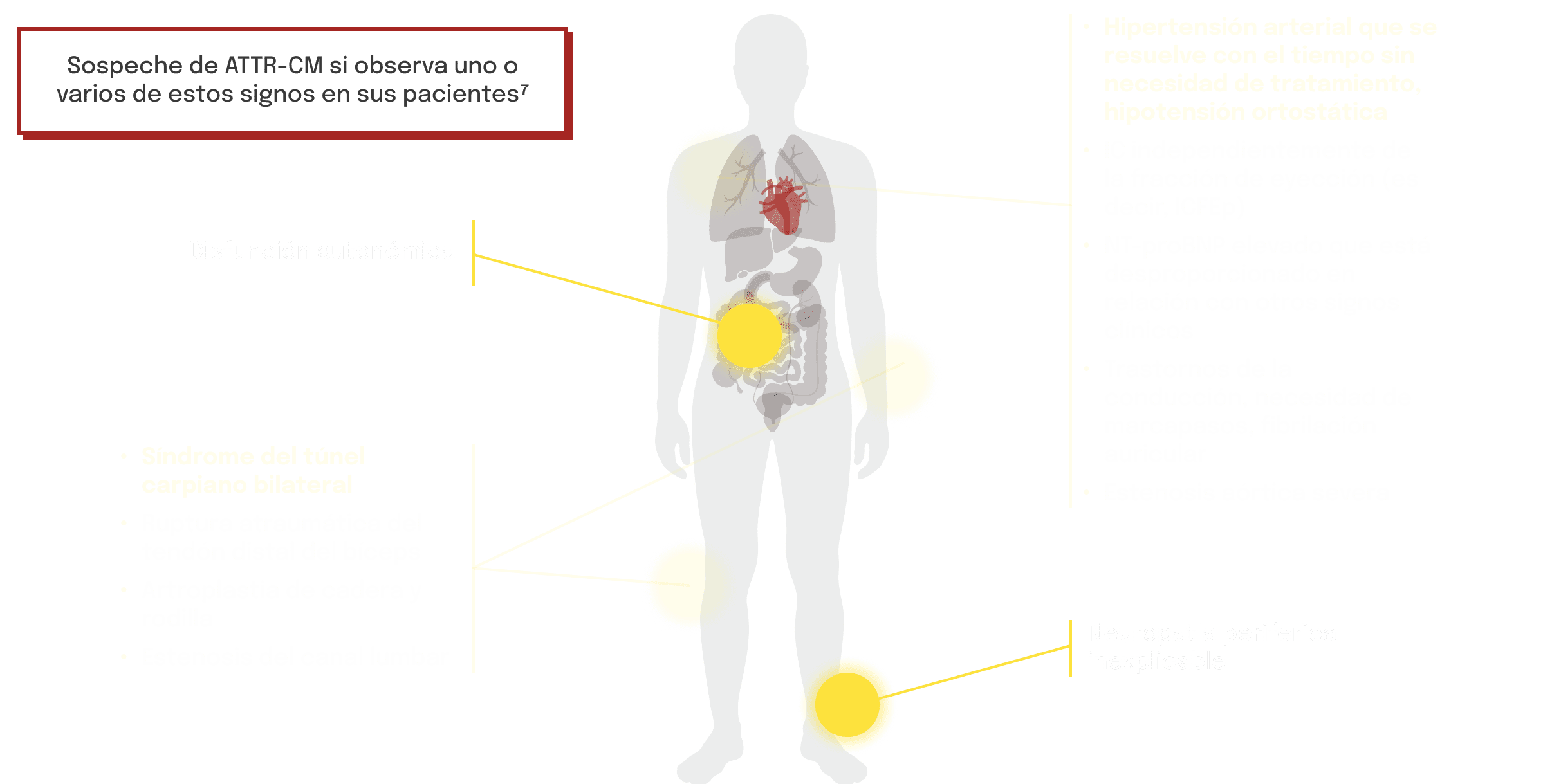 Diagrama que muestra la disfunción autonómica y la neuropatía periférica en la ATTR‑CM