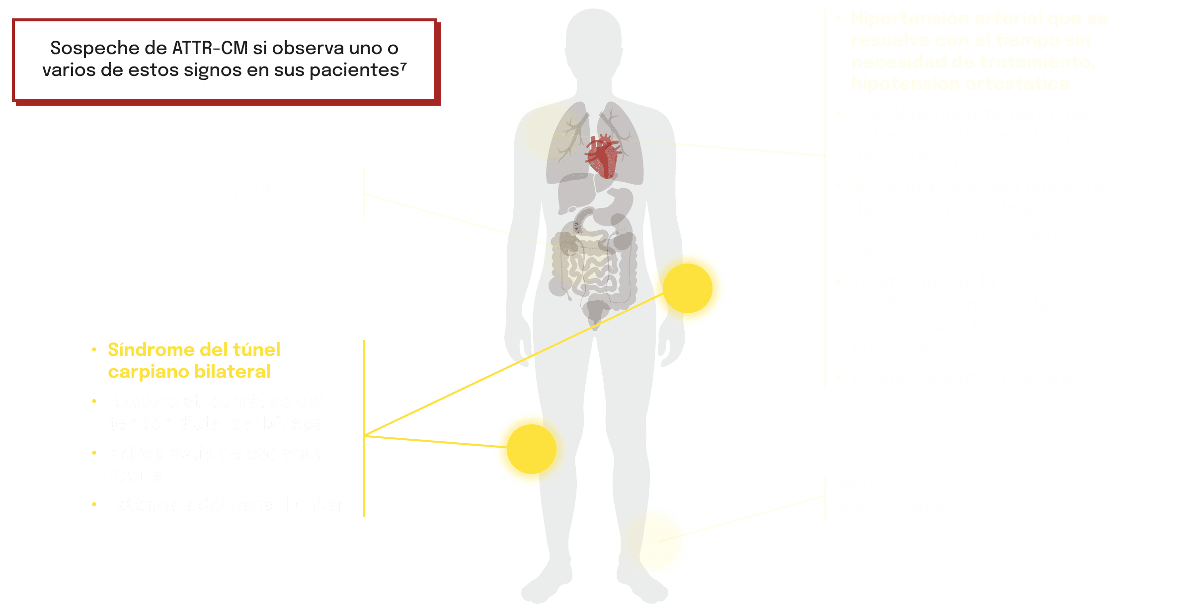 Principales señales de alerta de IC asociadas a la ATTR‑CM