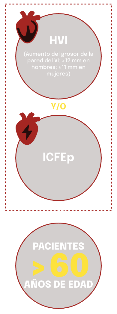 HVI e ICFEp: Señales clave de alerta de ATTR-CM
