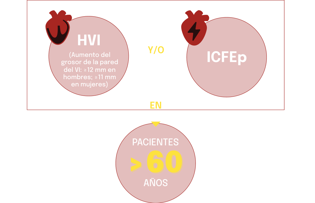 HVI y ICFEp: Señales clave de alerta de ATTR-CM